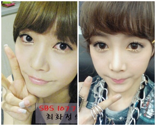 T-ara’s Soyeon: Before and After Circle Lens