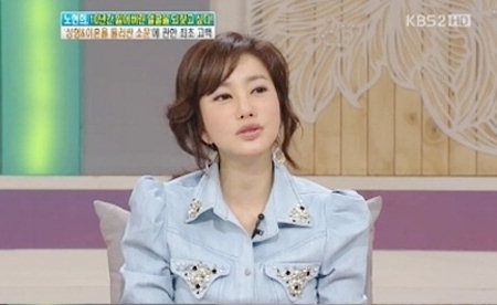 Actress No Hyun Hee Talks about Painful Plastic Surgery Experience