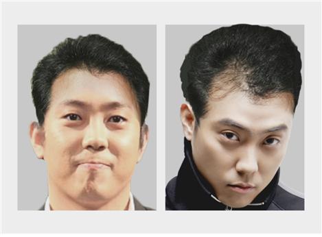 Will Eun Ji Won Go Bald in the Future?