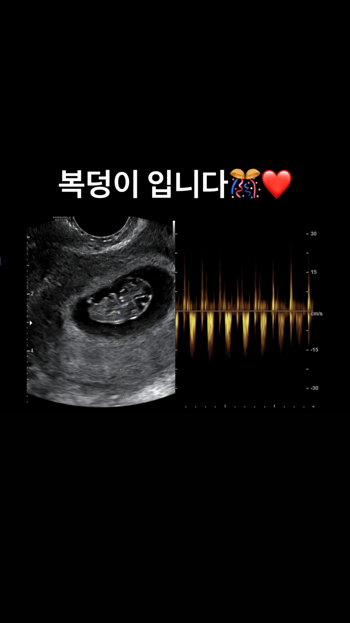 صورة شخصية لغو ووري من حسابها على إنستغرام