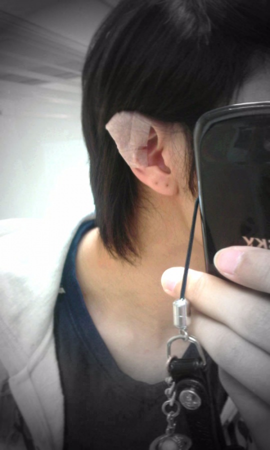 Alexander Tweets About His Ear Infection