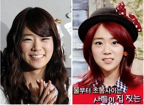 KARA Han Seung Yeon’s Changing Jaw Line Sparks Buzz