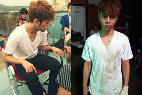 BEAST’s Yong Junhyung Gets Injured?