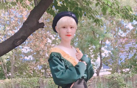 Yebin de DIA sufre una lesión en el tobillo mientras practica para “The Unit”